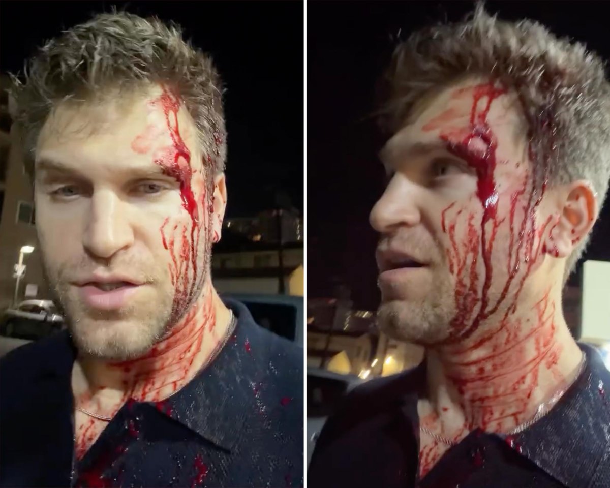 Keegan Allen Robbed at Gunpoint
