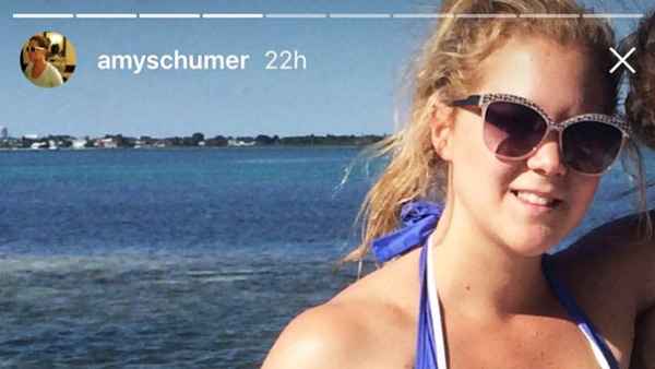 Amy Schumer