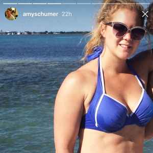 Amy Schumer