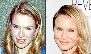 Renee Zellweger How Her Look Has Changed Through The Years Pictures