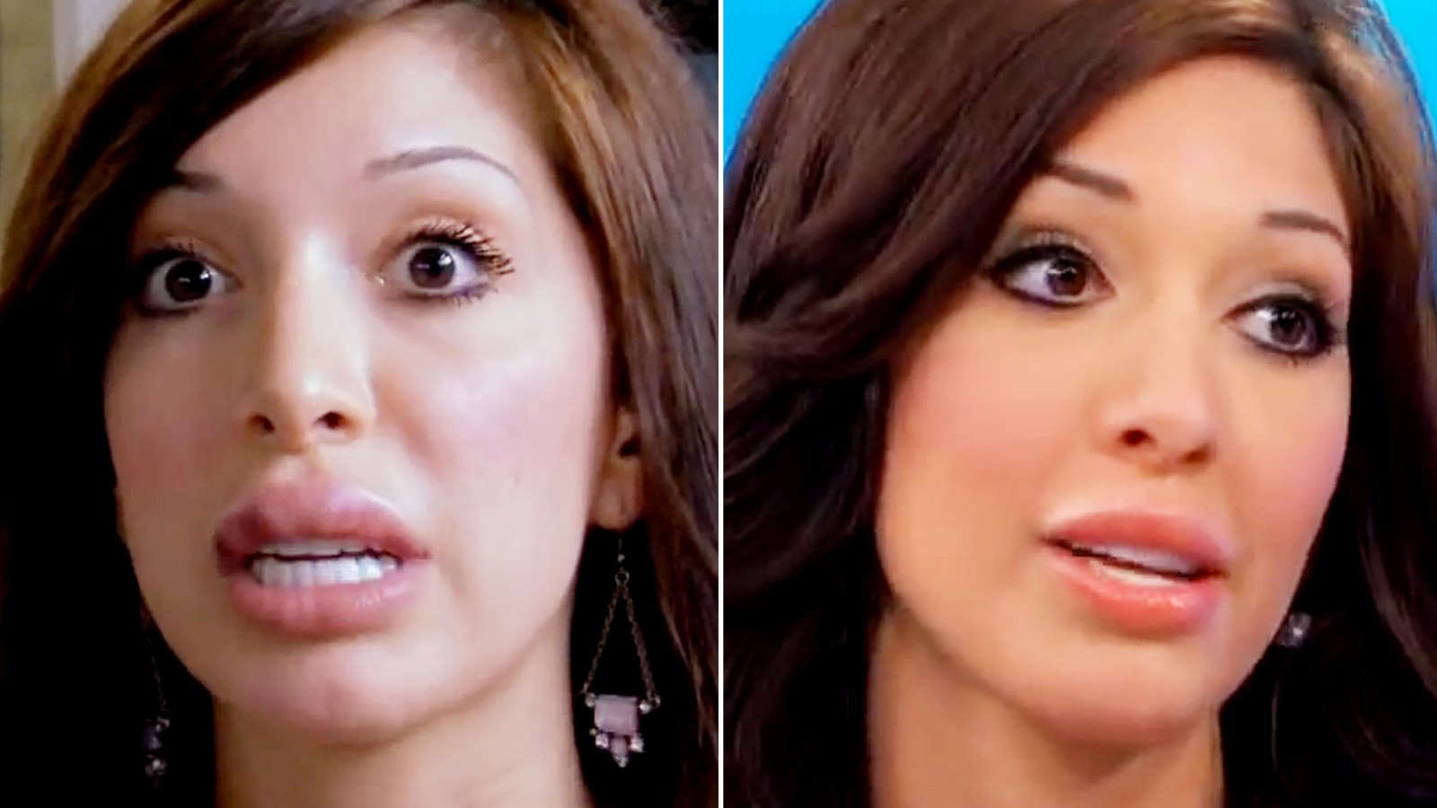 Farrah Abraham with her botched lip procedure and today