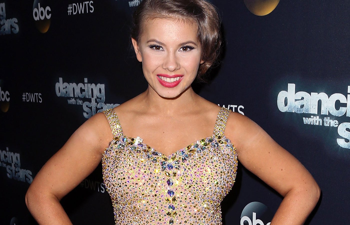 Bindi Irwin's toenails are falling off, and she's supergluing them bac