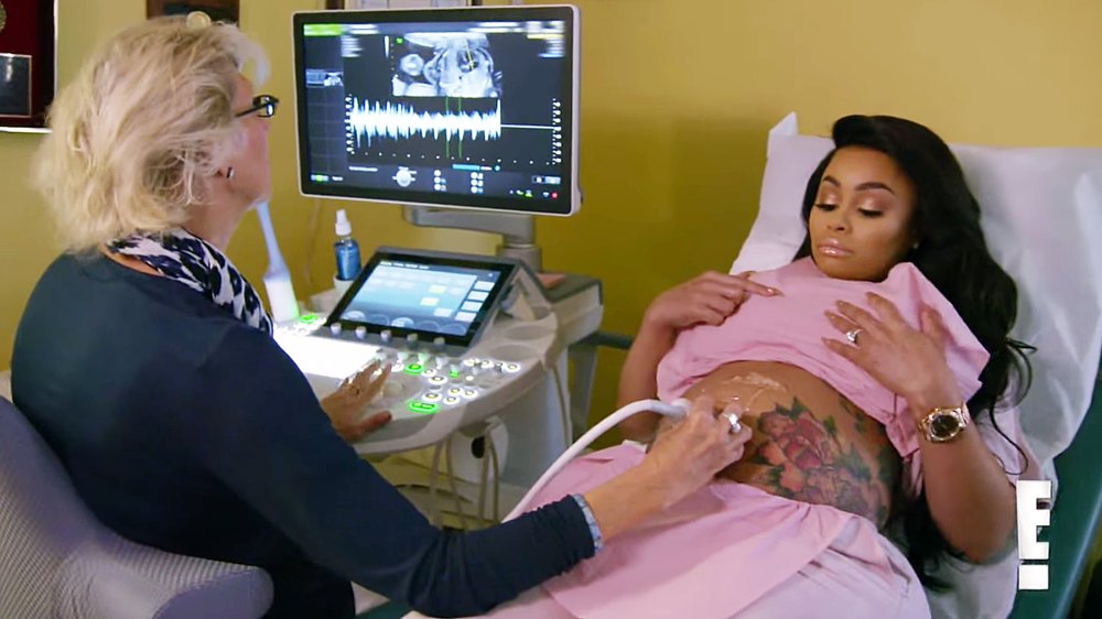 Blac Chyna ultrasound