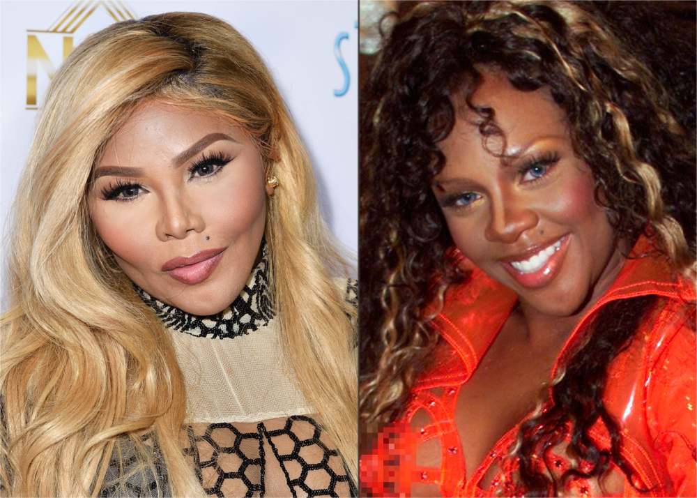 Lil' Kim's New Face: A Plastic Surgeon Weighs In