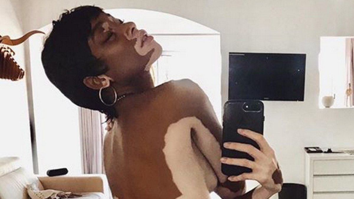 Winnie harlow naked 9b2d9c43 edfe 42d7 ab3e 1962cb7e2544