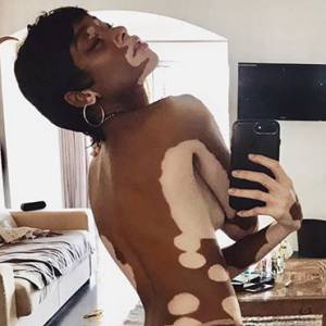 Winnie harlow naked 9b2d9c43 edfe 42d7 ab3e 1962cb7e2544